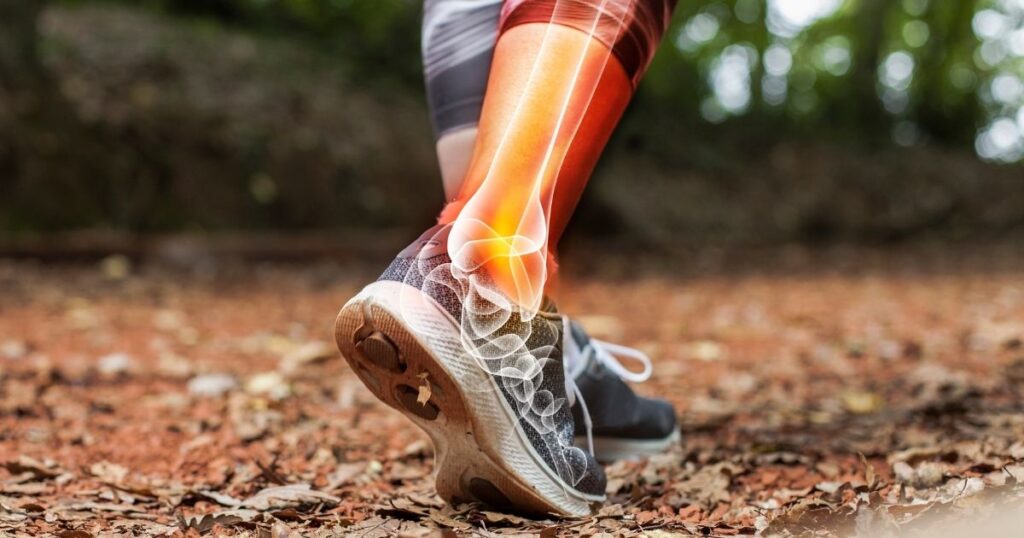 An image of a person's ankle with an x-ray effect to show the bones.